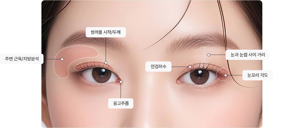 눈 분석 도식 — 주변 근육/지방분석 · 쌍꺼풀 시작/두께 · 몽고주름 · 안검하수 · 눈과 눈썹 사이 거리 · 눈꼬리 각도